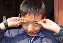 <b>孩子抽动症频繁眨眼用经颅磁刺激仪有用吗？</b>